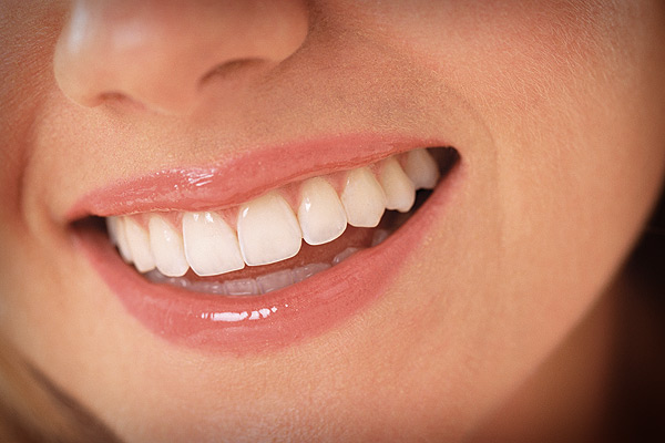 Teeth Whitening in Coral Gables